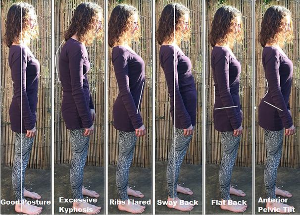 posture postnatal abdominal seperation